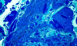 Springer Nature releases first half results